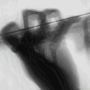 手指怎么靠拢？